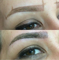 میکروبلیدینگ