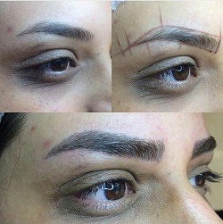 میکروبلیدینگ